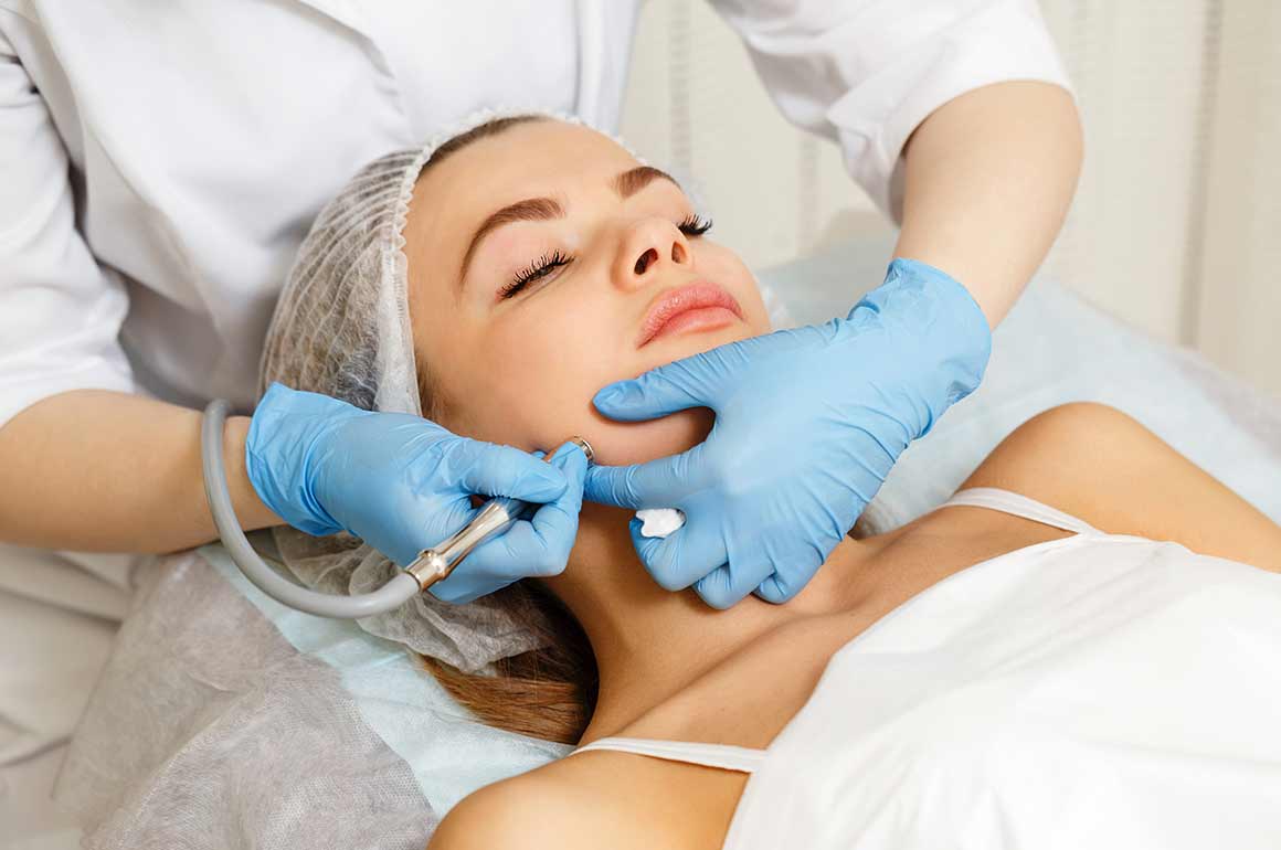 microdermabrasion-02.jpg